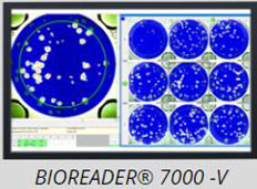 可见光多功能elispot检测分析仪-酶联免疫斑点检测分析仪，德国bioreader 7000-v